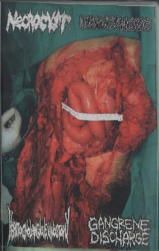 Gangrene Discharge : Gangrene Discharge - Urinophobic - Hepatocholangiojejunostomy - Necrocyst